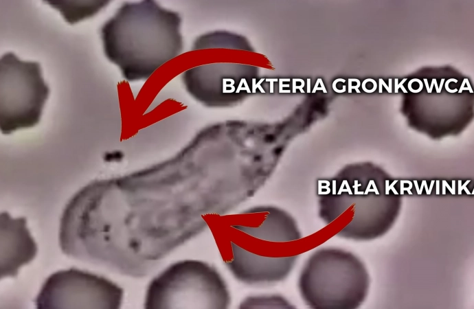 Zobaczcie nagranie układu odpornościowego walczącego z bakteriami